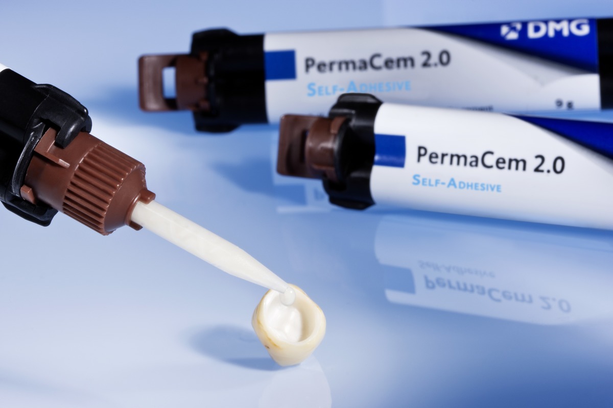 Permacem 2 0 Dual Cured Self Adhesive Composite Implant Line